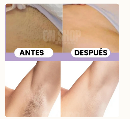 Depilatore 2 in 1 Noare – Pelle Liscia Senza Irritazioni